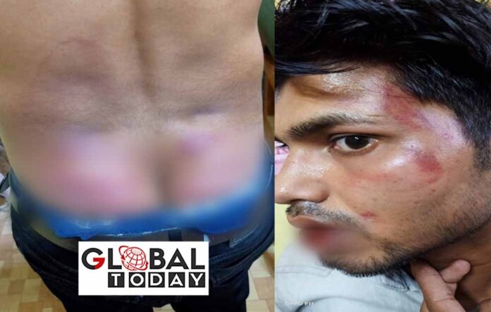 रीवा में डॉक्टरों की गुंडागर्दी,बंधक बनाकर SAF जवान को पीटा