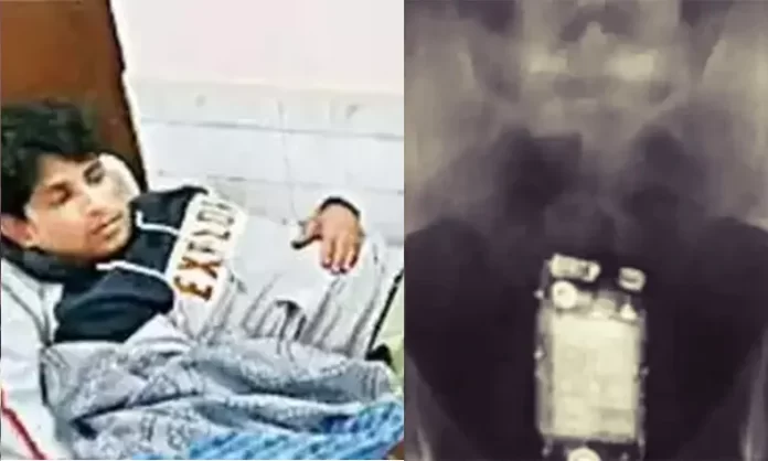कैदी ने निगला मोबाइल