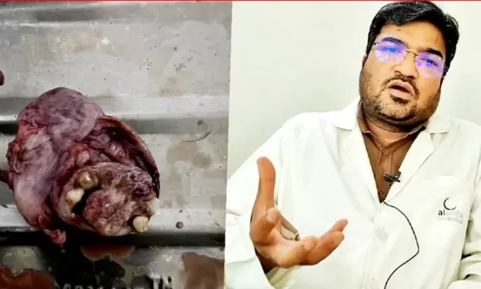 अलशिफा के डाक्टर ने किया मुश्किल ऑप्रेशन