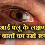 आई फ्लू को लेकर घबरायें नहीं