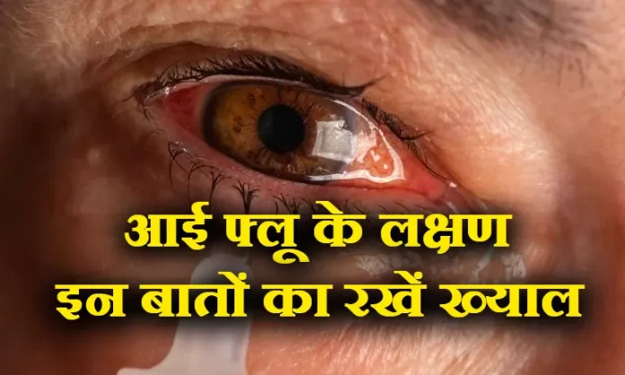 आई फ्लू को लेकर घबरायें नहीं