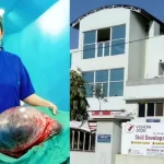 अल शिफा अस्पताल में महिला के पेट से निकला 22 किलो का ट्यूमर