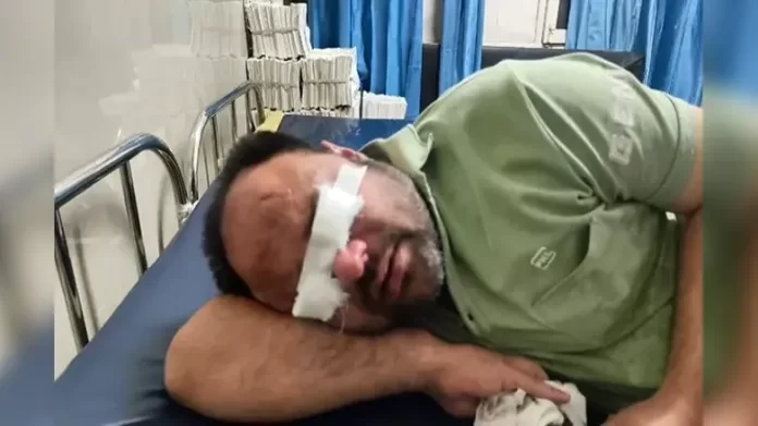 60 people had to pay a heavy price for getting free treatment for baldness, they were admitted in hospital