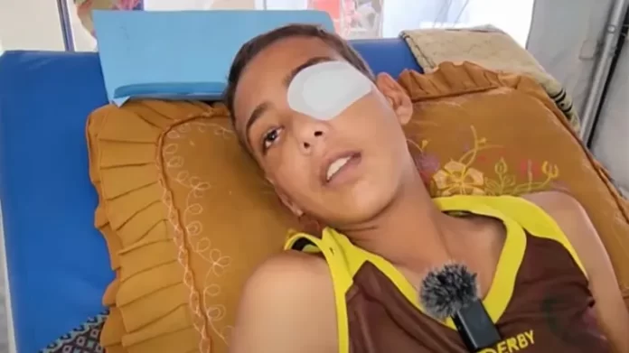 Abdul Rehman Jazar Israel forces shoot Palestinian boy in eye at aid site amid Gaza starvation