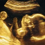 A revolution in infertility treatment: Chinese scientists create a 'mini-worm on a chip'