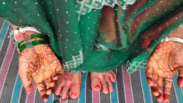 Badaun News badaun suhagrat groom death