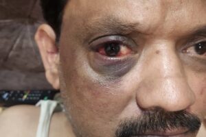 बदायूं: बिजली फॉल्ट ठीक करने गए जेई और लाइनमैन से मारपीट, बंधक बनाकर पीटा; 4 पर केस दर्ज 8 JE Badaun